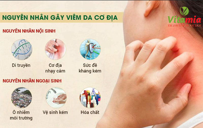 NƯỚC ĐIỆN GIẢI HỖ TRỢ ĐIỀU TRỊ BỆNH VIÊM DA CƠ ĐỊA HIỆU QUẢ CAO